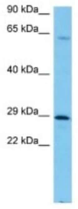 FAM58A Rabbit anti-Mouse, Polyclonal, Novus Biologicals 100 &mu;g; Unconjugated:Antibodies,